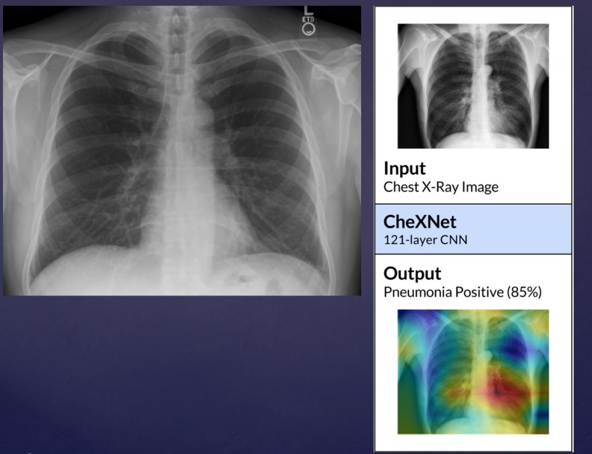 Chatbot chẩn đoán ảnh chụp X-quang